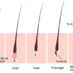 6 cách giúp kích thích mọc tóc nhanh và hiệu quả