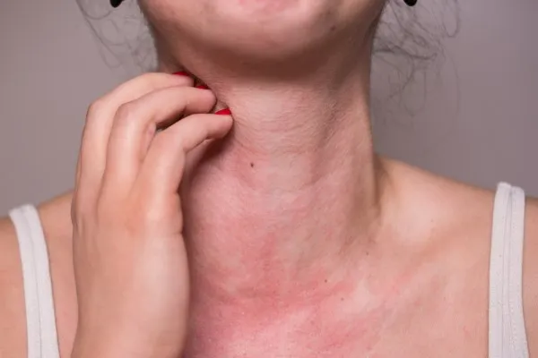 Cẩm nang sử dụng an toàn: Những ai không nên uống nước lá đu đủ? 3
